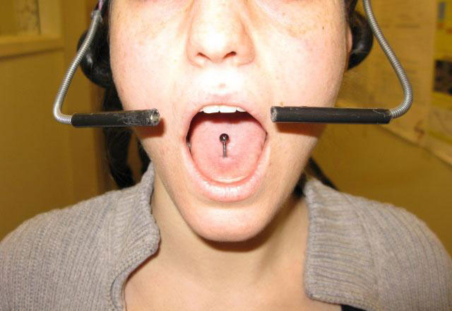 Tongue-Operated Devices Help Paralyzed People